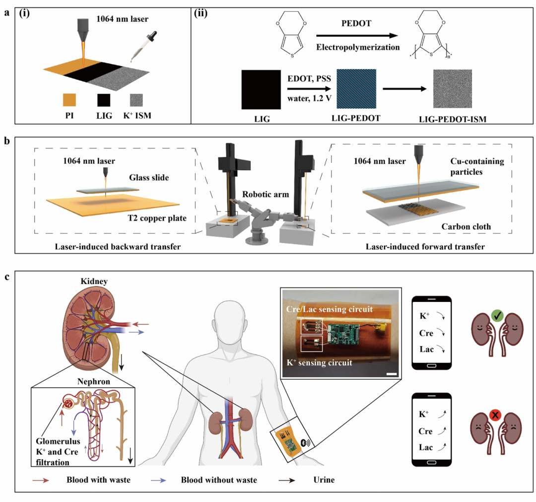 Biosensors&Bioelectronics：多功能激光诱导石墨烯电路和激光打印纳米材料用于无创人体肾脏功能监测