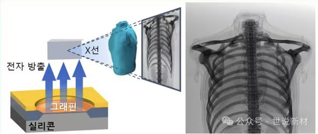 全球首次！韩国LG电子开发的石墨烯半导体制成的X射线设备成功用于医学影像领域